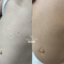 Load image into Gallery viewer, Mollumclear Starter Bundle